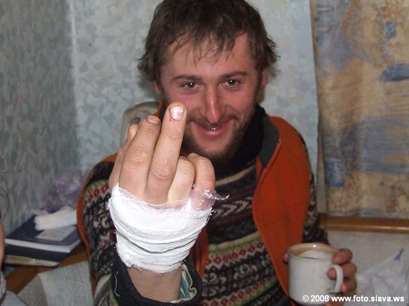 Раненый Пожарник